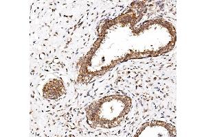 IHC analysis of NDP52/CALCOCO2 using anti-NDP52/CALCOCO2 antibody (ABIN7599401).