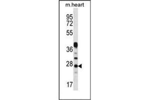Western blot analysis of Beta-crystallin A3 Antibody  in Mouse heart tissue lysates (35ug/lane). (CRYBA1 抗体  (Middle Region))