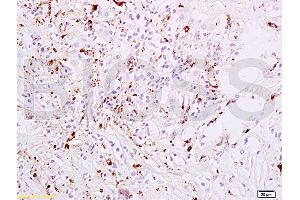 Immunohistochemistry (IHC) image for anti-Signal Transducer and Activator of Transcription 6, Interleukin-4 Induced (STAT6) (pTyr641) antibody (ABIN734483)