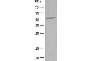 Western Blotting (WB) image for Inositol-Tetrakisphosphate 1-Kinase (ITPK1) (AA 1-414) protein (His tag) (ABIN7123440) (ITPK1 Protein (AA 1-414) (His tag))