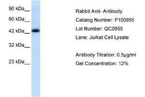 Lane: Jurkat cell LysateAntibody Dilution: 0. (Anti-MBP-1 (Middle Region) 抗体)