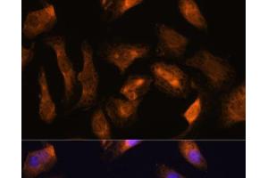 Immunofluorescence analysis of U-2 OS cells using RPS17 Polyclonal Antibody at dilution of 1:100. (RPS17 抗体)