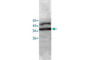 Western blot analysis of Jurkat cell lysate with PECI polyclonal antibody  at 1 : 500 dilution. (PECI/ECI2 抗体  (AA 2-227))