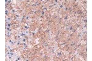 Immunohistochemistry (IHC) image for anti-Transgelin (TAGLN) (AA 1-201) antibody (ABIN7435139)