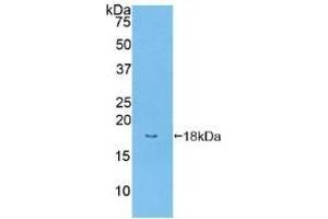 Detection of Recombinant BMPR2, Human using Polyclonal Antibody to Bone Morphogenetic Protein Receptor 2 (BMPR2) (BMPR2 抗体  (AA 27-150))