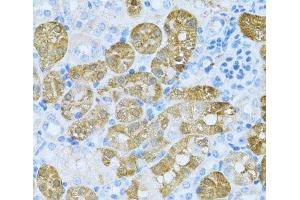 Immunohistochemistry of paraffin-embedded Mouse kidney using KLHL42 Polyclonal Antibody at dilution of 1:100 (40x lens). (KLHDC5 抗体)
