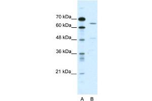 WB Suggested Anti-ACCN1 Antibody Titration:  0. (ACCN1 抗体  (C-Term))