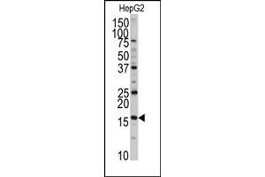 Image no. 1 for anti-DCTP Pyrophosphatase 1 (DCTPP1) (N-Term) antibody (ABIN357989) (DCTPP1 抗体  (N-Term))