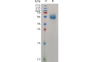 SDS-PAGE (SDS) image for Interleukin 31 (IL31) (AA 24-164) protein (Fc Tag) (ABIN7490875)