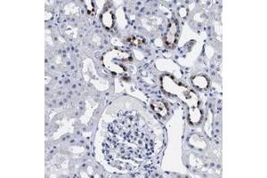 Immunohistochemical staining of human kidney with ATP6V0A4 polyclonal antibody  shows strong cytoplasmic positivity in cells in tubules at 1:50-1:200 dilution. (ATP6V0A4 抗体)