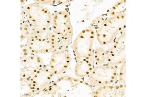 Immunohistochemistry (Paraffin-embedded Sections) (IHC (p)) image for anti-Poly A Binding Protein Nuclear 1 (PABPN1) antibody (ABIN7075116)