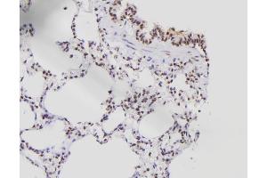 ABIN6261414 and ABIN6276538 at 1/100 staining Rat lung tissue by IHC-P. (E2F8 抗体  (C-Term))