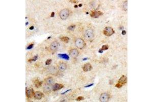 Immunohistochemical analysis of GABRG1 staining in human brain formalin fixed paraffin embedded tissue section. (GABRg1 抗体  (N-Term))