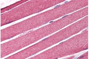 Human Skeletal Muscle (formalin-fixed, paraffin-embedded) stained with AICDA antibody ABIN214183 at 5 ug/ml followed by biotinylated goat anti-rabbit IgG secondary antibody ABIN481713, alkaline phosphatase-streptavidin and chromogen. (AICDA 抗体  (C-Term))