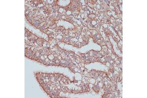 Immunohistochemistry of paraffin-embedded rat ovary using MOB4 antibody (ABIN6132926, ABIN6143935, ABIN6143936 and ABIN6220703) at dilution of 1:100 (40x lens). (MOBKL3 抗体  (AA 1-225))