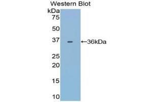Detection of Recombinant TRF, Bovine using Polyclonal Antibody to Transferrin (TF) (Transferrin 抗体)