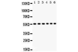 Anti- CD 8 alpha Picoband antibody, Western blotting All lanes: Anti CD 8 alpha  at 0. (CD8 alpha 抗体  (AA 22-187))
