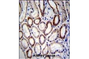 Immunohistochemistry (Paraffin-embedded Sections) (IHC (p)) image for anti-Branched Chain Amino-Acid Transaminase 2, Mitochondrial (BCAT2) (AA 309-336), (C-Term) antibody (ABIN656822)