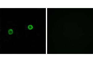 Peptide - +Western blot analysis of extracts from HeLa cells and COLO cells, using ACOT4 antibody. (ACOT4 抗体)