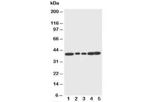 Western blot testing of Decorin antibody and Lane 1:  rat liver (Decorin 抗体  (C-Term))