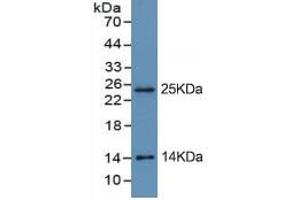 Rabbit Detection antibody from the kit in WB with Positive Control: Sample BXPC-3 cell lysate. (Trypsin ELISA 试剂盒)