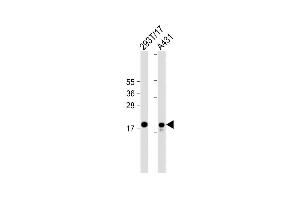 All lanes : Anti-UBE2C Antibody (C-term) at 1:2000 dilution Lane 1: 293T/17 whole cell lysate Lane 2: A431 whole cell lysate Lysates/proteins at 20 μg per lane. (UBE2C 抗体  (C-Term))