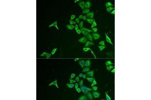 Immunofluorescence analysis of U2OS cells using INPP5J Polyclonal Antibody (INPP5J 抗体)