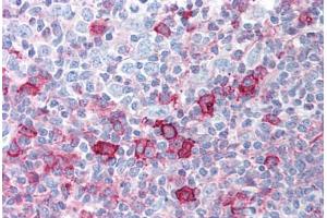 Human Tonsil (formalin-fixed, paraffin-embedded) stained with AKT1 antibody ABIN213755 at 5 ug/ml followed by biotinylated goat anti-rabbit IgG secondary antibody ABIN481713, alkaline phosphatase-streptavidin and chromogen. (AKT1 抗体  (pSer473))