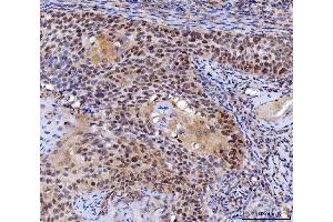 IHC analysis of MLH1 using anti-MLH1 antibody (ABIN7599691). (MLH1 抗体  (AA 108-756))