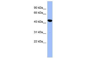 SERPINE2 antibody used at 1 ug/ml to detect target protein. (SERPINE2 抗体)