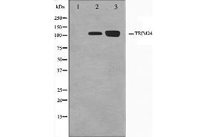 Western blot analysis on Jurkat and K562 cell lysate using TRIM24 Antibody. (TRIM24 抗体  (C-Term))