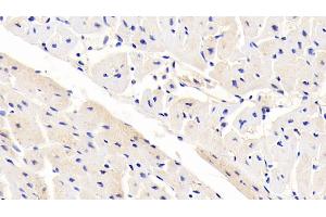 Detection of LRP6 in Human Cardiac Muscle Tissue using Polyclonal Antibody to Low Density Lipoprotein Receptor Related Protein 6 (LRP6) (LRP6 抗体  (AA 981-1213))