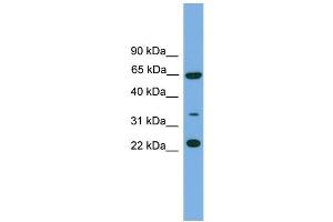 WB Suggested Anti-TRAPPC5 Antibody Titration: 0. (TRAPPC5 抗体  (N-Term))