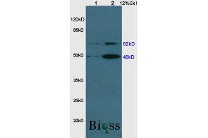 SDS-PAGE (SDS) image for anti-Sequestosome 1 (SQSTM1) (AA 51-150) antibody (ABIN682153)