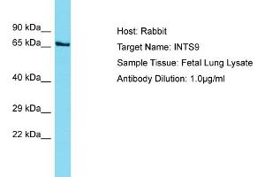 Host: Rabbit Target Name: INTS9 Sample Tissue: Human Fetal Lung Antibody Dilution: 1ug/ml (INTS9 抗体  (C-Term))