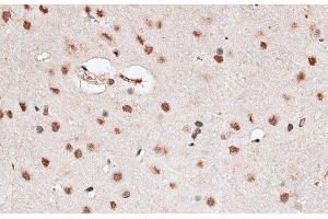 Immunohistochemistry of paraffin-embedded Rat brain using RBM3 Polyclonal Antibody at dilution of 1:100 (40x lens). (RBM3 抗体)