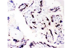 IHC-P: C/EBP beta antibody testing of human placenta tissue (CEBPB 抗体  (AA 1-200))