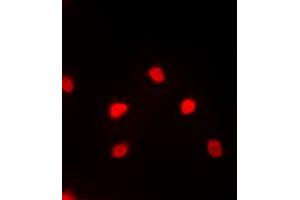 Immunofluorescent analysis of MEF2C staining in PC12 cells. (MEF2C 抗体  (C-Term))