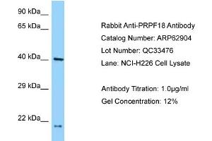Western Blotting (WB) image for anti-PRP18 Pre-mRNA Processing Factor 18 (PRPF18) (N-Term) antibody (ABIN2789288) (PRPF18 抗体  (N-Term))