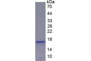 Rabbit Detection antibody from the kit in WB with Positive Control: Sample Rat Liver lysate. (Renin ELISA 试剂盒)