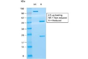 SDS-PAGE Analysis of Purified CD8a Mouse Recombinant Monoclonal Antibody ABIN6383871. (Recombinant CD8 alpha 抗体)