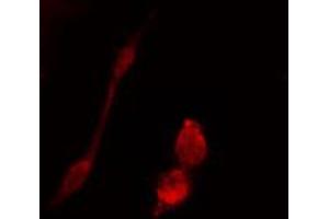 ABIN6274442 staining 293 cells by IF/ICC. (BRSK1 抗体  (Internal Region))