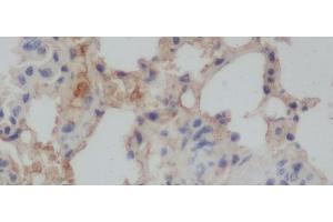 Immunohistochemistry of paraffin-embedded Rat lung using Aβ40 Polyclonal Antibody at dilution of 1:50 (Abeta 1-40 抗体)