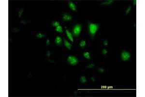 Immunofluorescence of monoclonal antibody to STK33 on HeLa cell. (STK33 抗体  (AA 1-514))