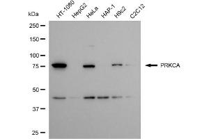 Western blotting analysis using PRKCA antibody (ABIN7799990).