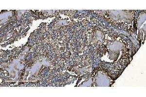 IHC analysis of MIEF1 using anti-MIEF1 antibody (ABIN7600396).