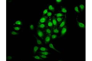 Immunofluorescence staining of A549 cells with ABIN7161832 at 1:100, counter-stained with DAPI. (NUP98 抗体  (AA 965-1110))