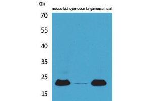 Adrenomedullin 抗体  (Internal Region)