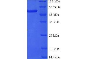 SDS-PAGE (SDS) image for delta Like Protein 3 (DLL3) (AA 27-492), (Extracellular) protein (His tag) (ABIN5714494)