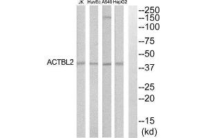 Western Blotting (WB) image for anti-Actin, beta-Like 2 (ACTBL2) (Internal Region) antibody (ABIN1852742) (ACTBL2 抗体  (Internal Region))